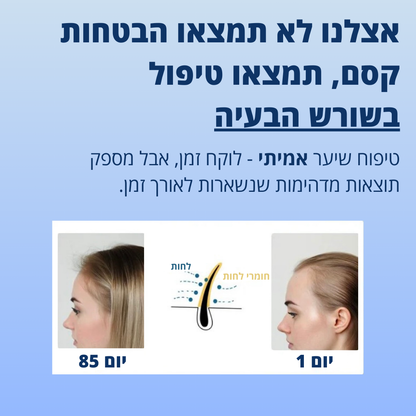 סרום טבעי לצמיחת שיער - דקה ביום